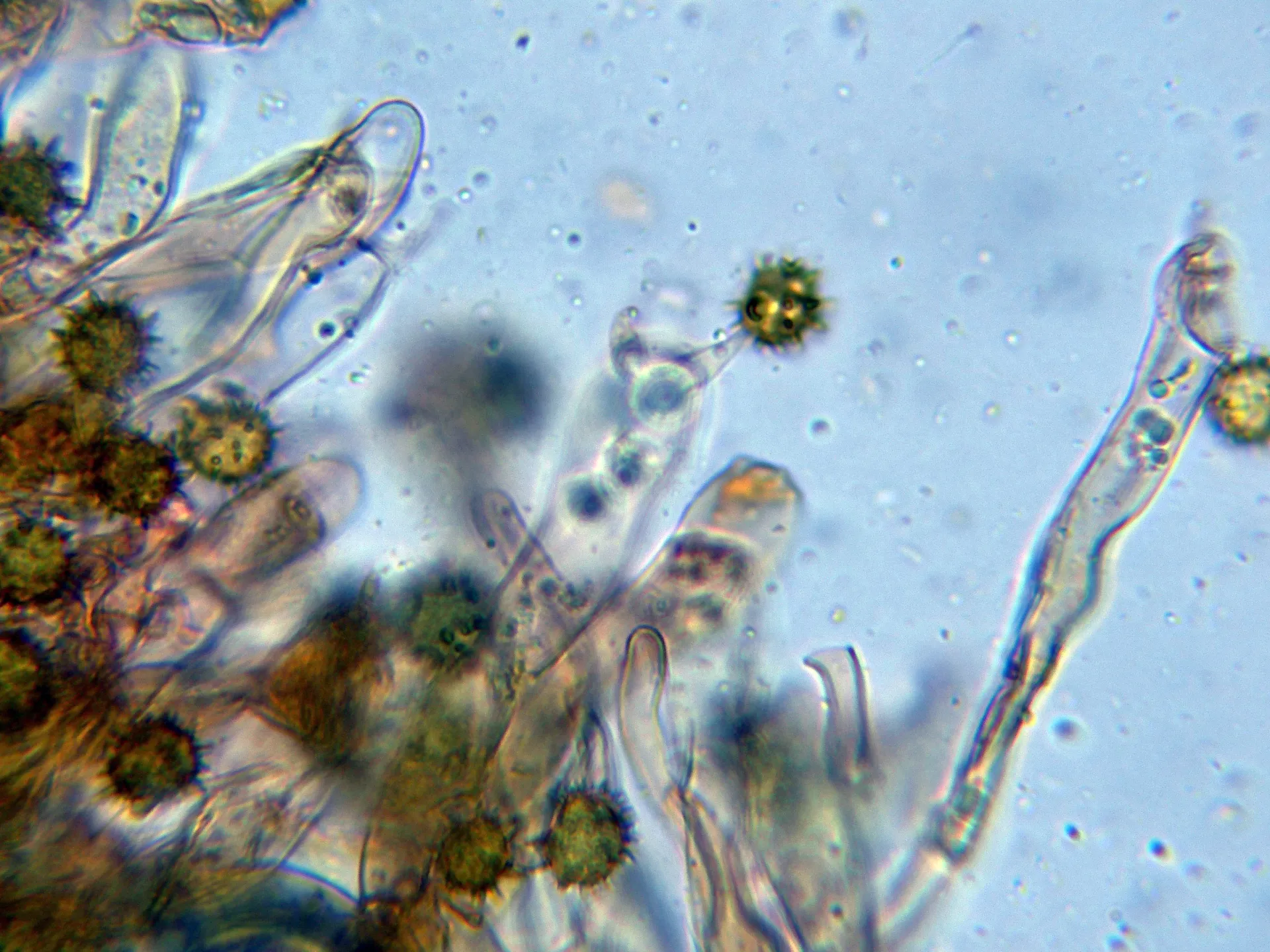 Microscopía de Tomentella bryophila - 10 - Basidios-003 (2)